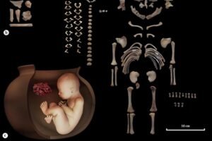 İran’da Çömleklere Gömülmüş 6.500 Yıllık Fetüsler Bulundu